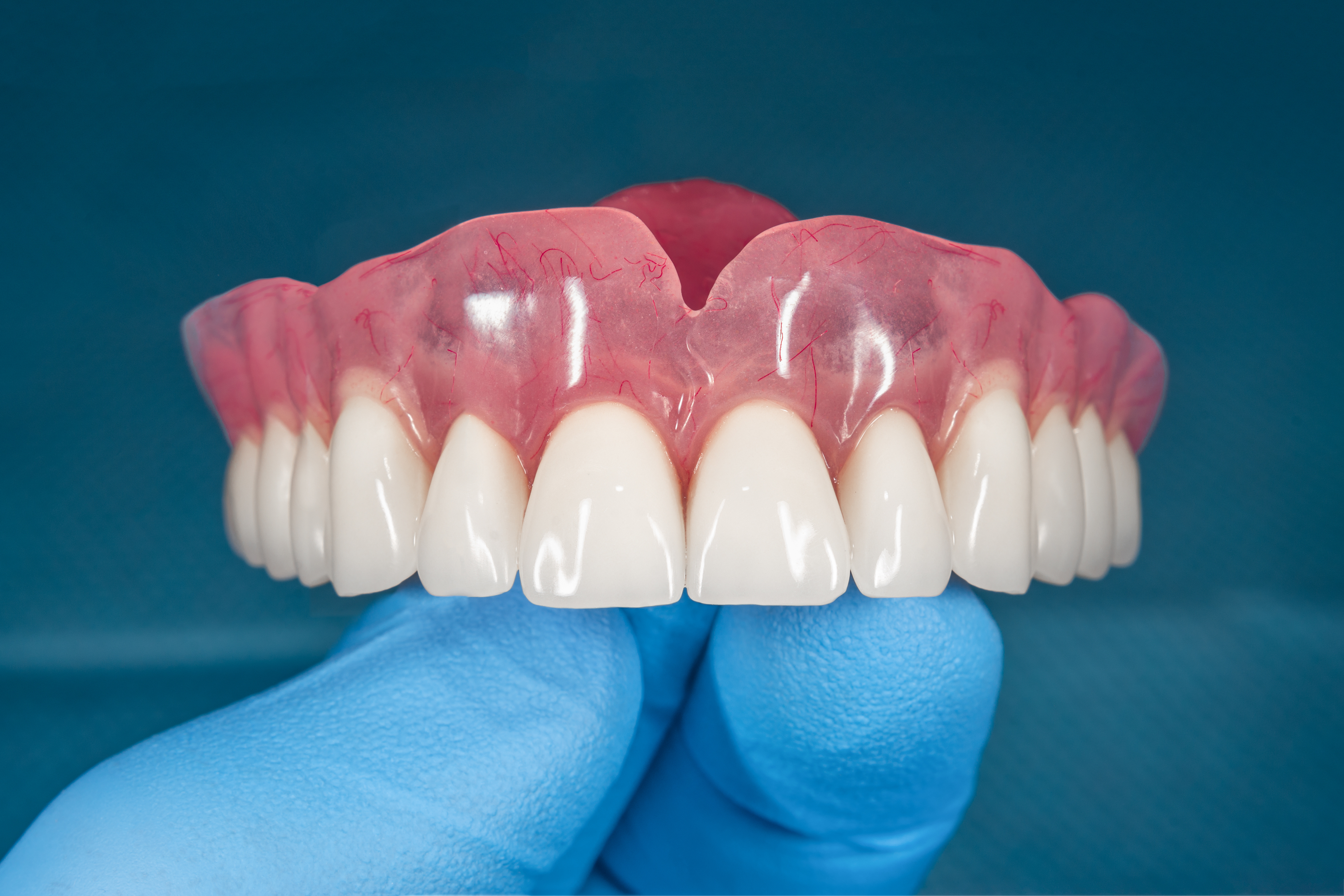 Denture repair