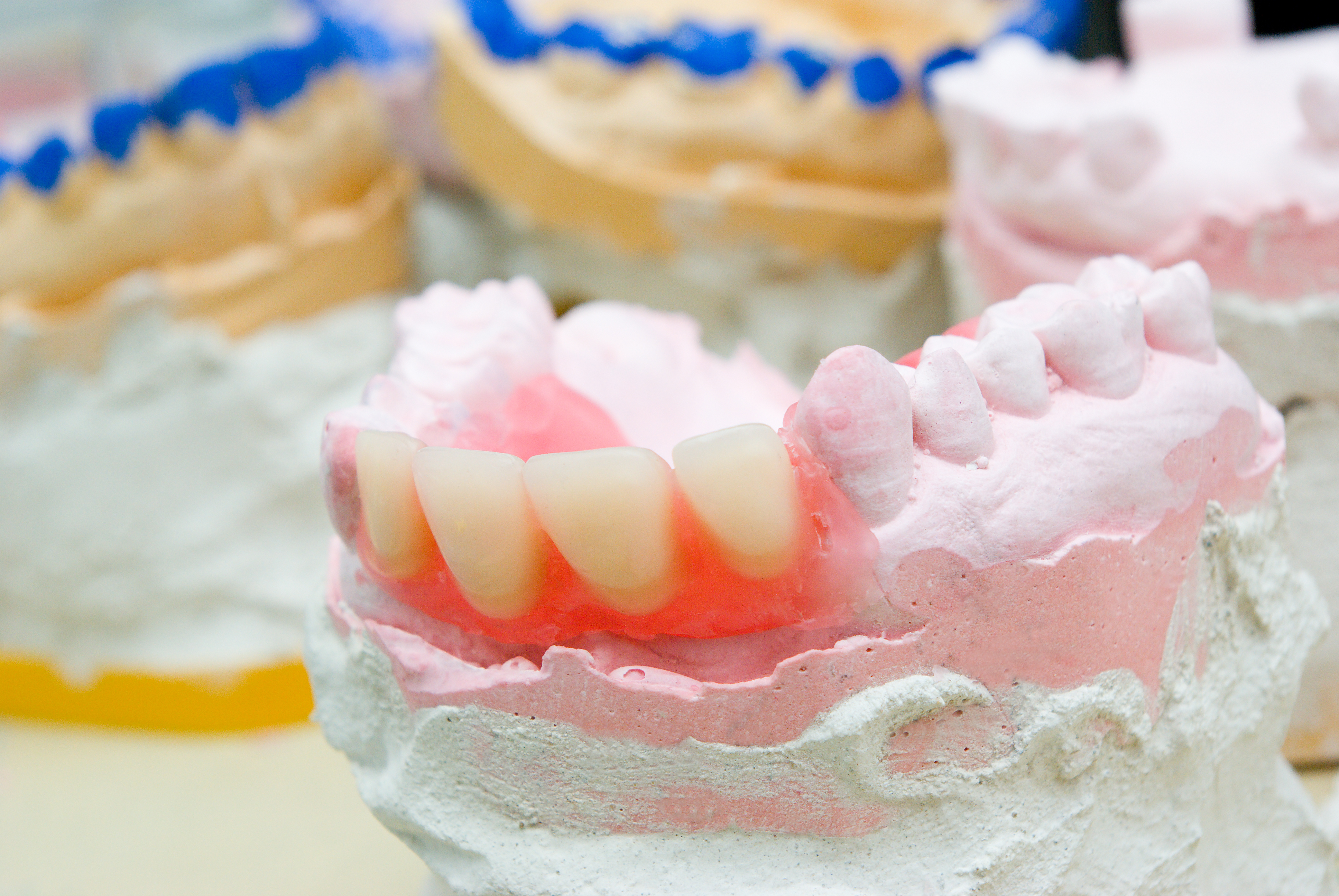 Denture repair