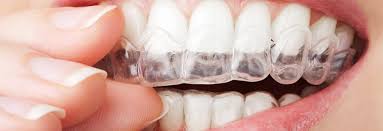 Denture repairs